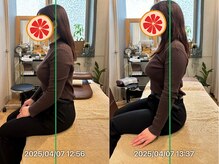 グレフル鍼灸接骨院 整体院 心斎橋/