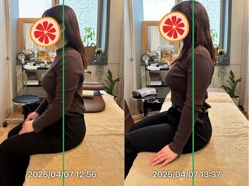 グレフル鍼灸接骨院 整体院 心斎橋/