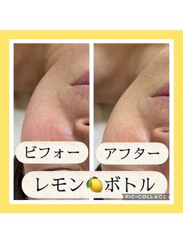 ファブール/レモンボトル パｙク付き