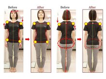 大川カイロプラクティックセンター なかのぶ整体院の雰囲気（一瞬で姿勢が整い、お顔が引きあがります。さらいバストアップも）