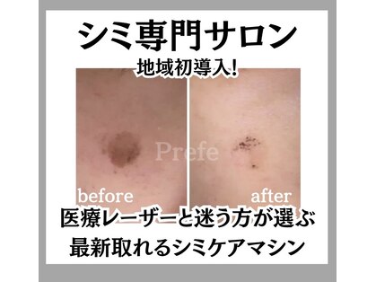 プリフェ(Prefe)の写真