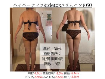 メイリー(MEILLI)/産後ダイエットもお任せください