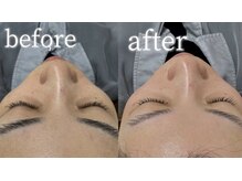 【まつげパーマ/眉毛/HBL/フェイシャルワックス専門店】C.（シードット）神戸三宮店/フェイシャルwaxト-ンアップ効果