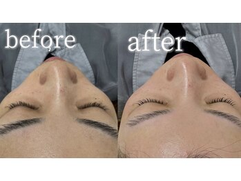 【まつげパーマ/眉毛/HBL/フェイシャルワックス専門店】C.（シードット）神戸三宮店/フェイシャルwaxト-ンアップ効果