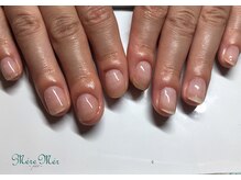 メールメール 和光市本店(MereMer)/（経過）113 深爪 深爪緩和 ケア