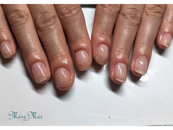 メールメール 和光市本店(MereMer)/（経過）113 深爪 深爪緩和 ケア