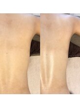 カロン(Kalon)/バザルトボディで背中美人♪