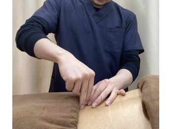 エバーグリーン鍼灸整骨院 九段下院/鍼灸【九段下/東京】