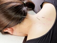 しろねこ鍼灸マッサージ院の雰囲気（身体の状態にあわせたマッサージや鍼施術をご提供☆）