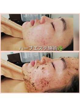 エクラ(eclat)/ハーブエステ