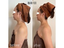 バンブー(bamboo)/ビフォーアフター