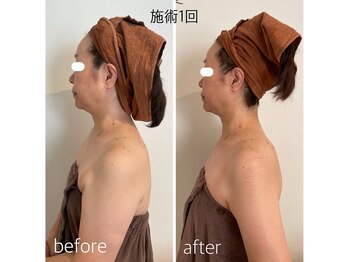 バンブー(bamboo)/ビフォーアフター