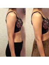 クオレア(cuorea)/バストアップに欠かせない肩周り