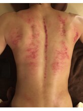 ディーテ(diiite)/