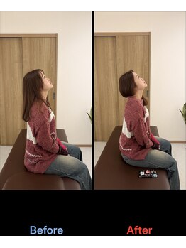 GWRいこい整体院/【首こり Before After】