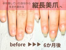 ナチュリア(Natulea)