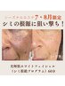 【初回】光輝肌ホワイトフェイシャル（シミ根絶プログラム）60分