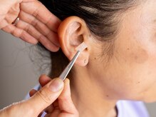 よこた針灸整骨院