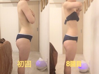 ディア スプリーマの写真/口コミ高評価◎結果を求めるなら当サロンへ★最新技術とゴッドハンドでがっつり痩身！見た目の変化に感動！