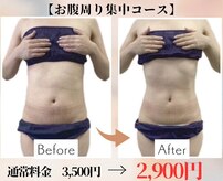 リルーチェ 倉敷(Riluce)