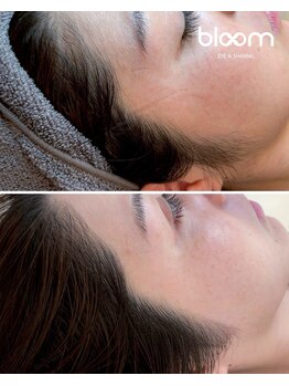 ブルーム 四条烏丸(bloom)/肌質改善シェービング