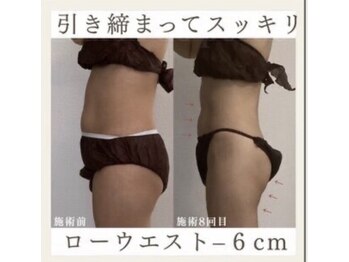 サロンドペシェ(salon de peche)/30代*痩身コース8回目