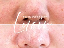 ルシール 仙台店(lucir)/毛穴セットメニューで更に綺麗★