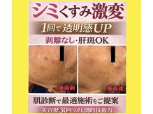 オンリーホープ(ONLY HOPE)