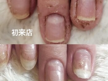 ココモ(cocomo)/(深爪/長さだし/フィルイン/)