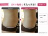 【お腹周り集中ケ】スッキリしたお腹を目指す!3名限定5回モニター ¥15000