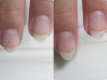 リル(relle)/スカルプ*長さ出し