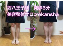 美容整体サロン オオカンシャ(okansha)/O脚BeforeAfter