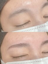 ワフトヒルズ 津田沼店(Waft Hills)/wax脱毛