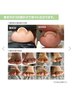 【導入キャンペーン】巻き爪改善/専用の特殊ジェル使用/爪矯正/マグネット