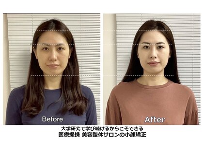 アヴァンティーズ 横浜(AVANTIS)の写真