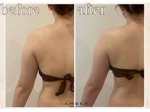 アンバー 恵比寿(AMBER)/慢性的な肩こりや巻き肩解消！