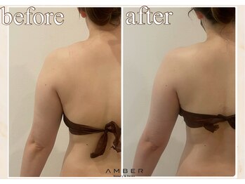 アンバー 恵比寿(AMBER)/慢性的な肩こりや巻き肩解消！