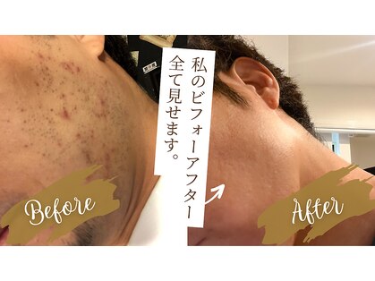 カズキハギワラ(Kazuki Hagiwara)の写真