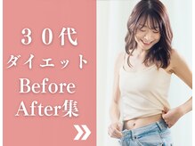 セルケア ギンザ(CellCare GINZA)/