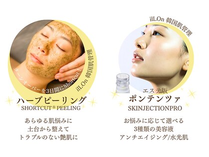 アルッカ(Arukka)の写真