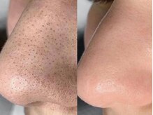 マリヴェリーテ(Mari verite)の雰囲気（毛穴洗浄×韓国式イオン導入でトラブルのない美肌に導きます。）