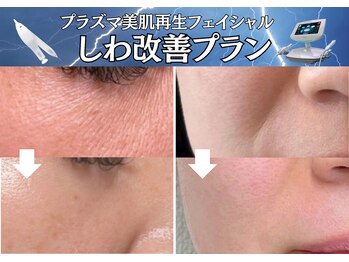 マキシア(MaxiA)の写真/【40代・50代必見】年齢に負けない肌へ導く◆最新ケアでほうれい線・たるみ改善◎若見え肌へ