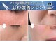 マキシア(MaxiA)の写真/【40代・50代必見】年齢に負けない肌へ導く◆最新ケアでほうれい線・たるみ改善◎若見え肌へ