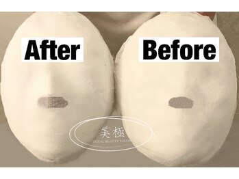 美極 トータルビューティー(美極 TOTAL BEAUTY)/恵比寿/小顔コルギ/エステ/