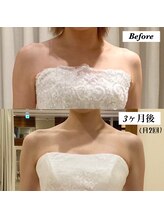 カラー 北浜店(CALLA)/【挙式3ヶ月前からのケア】