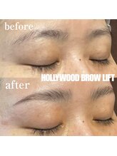 ブリリアント(brilliant)/ハリウッドブロウリフト