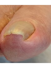 001 新横浜/突き刺さっていてもOKです