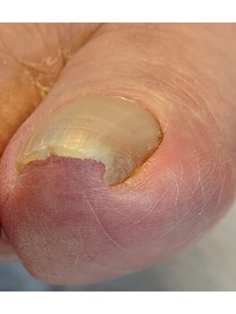 001 新横浜/突き刺さっていてもOKです