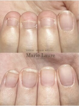 マリーロール 天王寺店(Marie Laure)/自爪育成/深爪矯正/ネイルケア