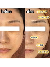 ニューズビューティー(neu's beauty)/ワックス × ピーリング♪